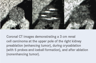 Michelle Lung, MD